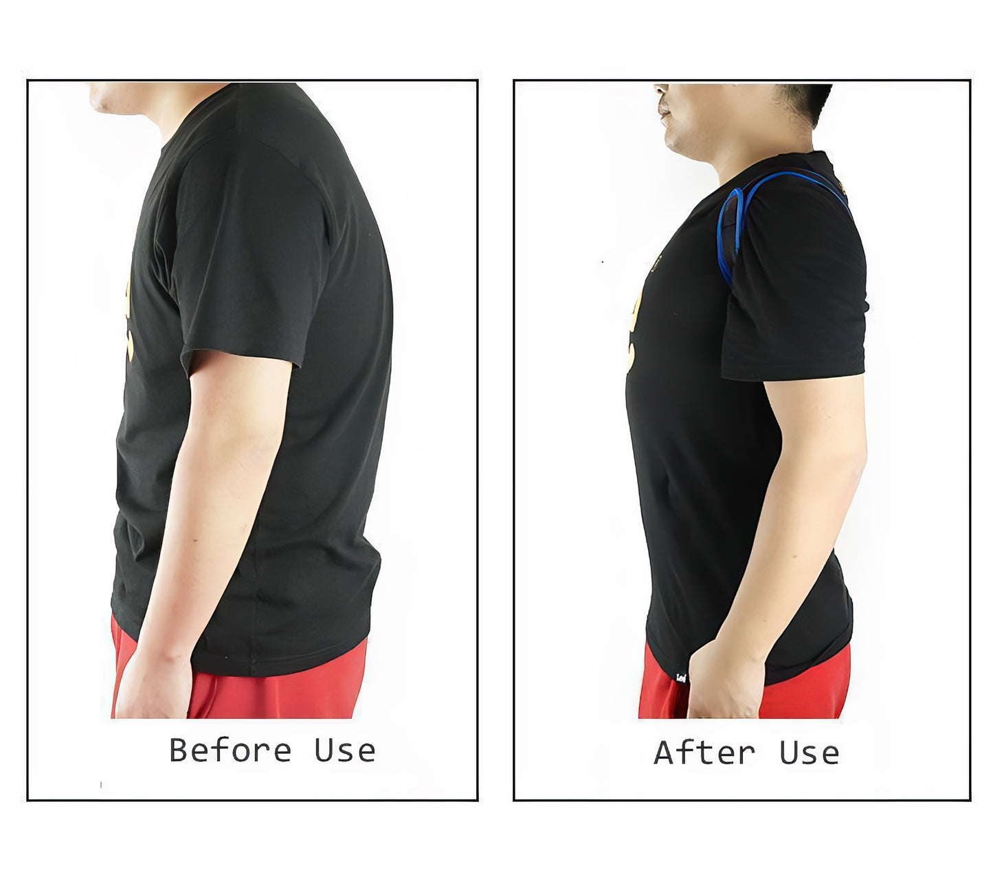 Invisible Back Posture Corrector